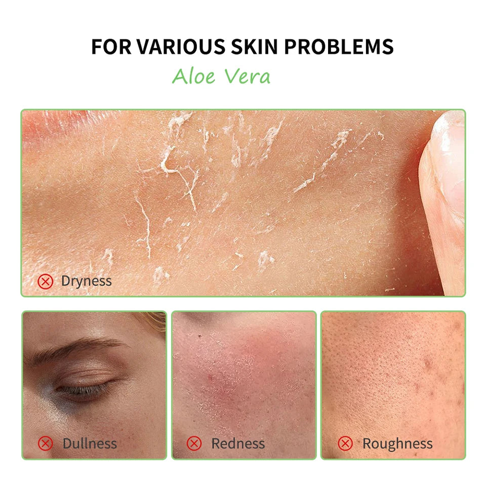 🌿 Coffret Soin Aloe Vera – Hydratation Intense & Peau Éclatante 🌿