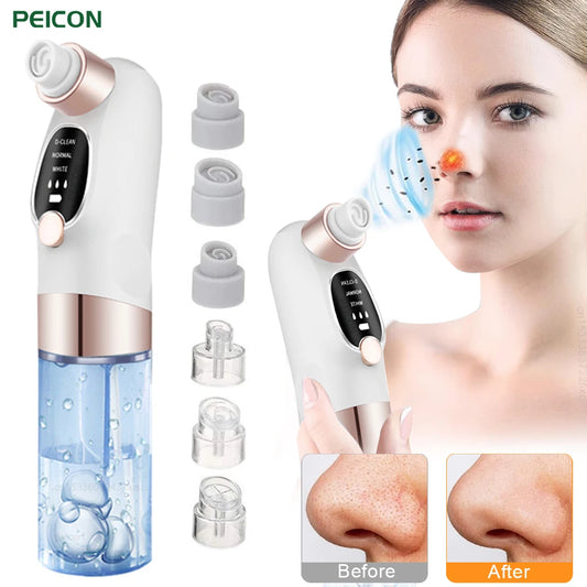 Aspirateur de Points Noirs Luméa – Nettoyeur de Pores & Soin Visage Profond