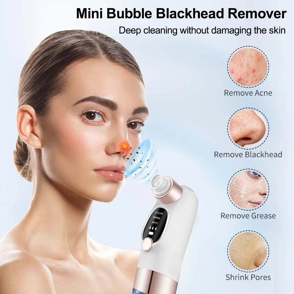 Aspirateur de Points Noirs Luméa – Nettoyeur de Pores & Soin Visage Profond