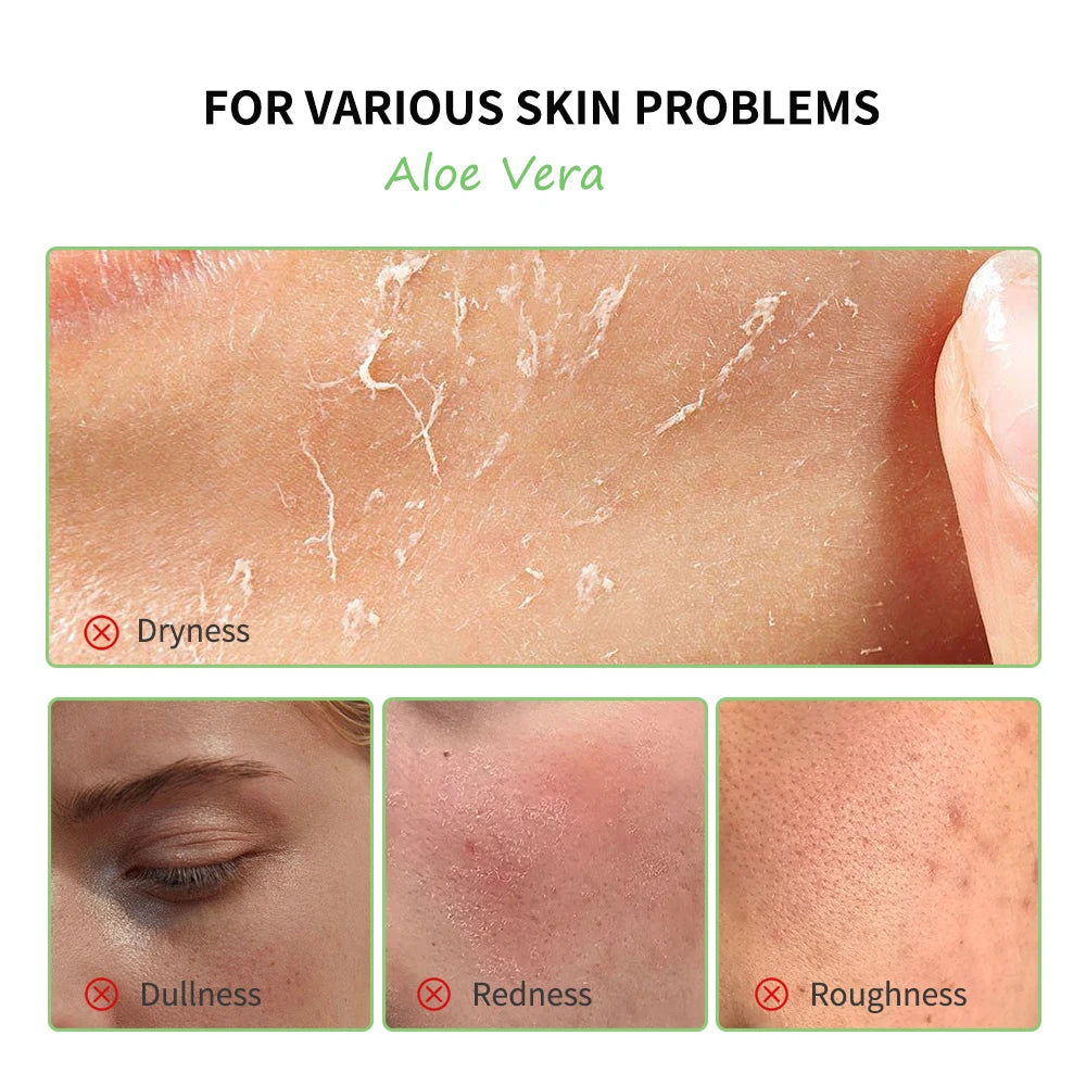 🌿 Coffret Soin Aloe Vera – Hydratation Intense & Peau Éclatante 🌿