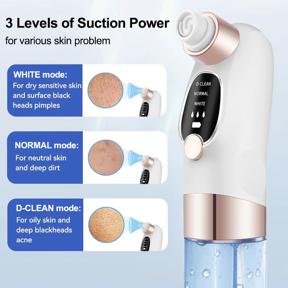 Aspirateur de Points Noirs Luméa – Nettoyeur de Pores & Soin Visage Profond