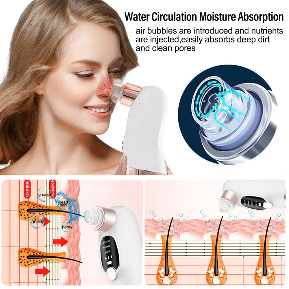 Aspirateur de Points Noirs Luméa – Nettoyeur de Pores & Soin Visage Profond